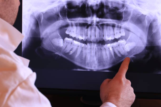 Best Emergency Dentist for Lost Fillings or Crowns in Kincaid, IL