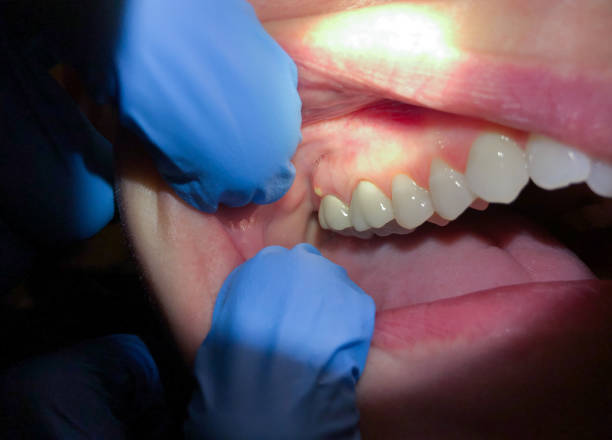 Best Weekend Emergency Dentist in Kincaid, IL